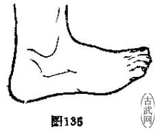 ͼ135
